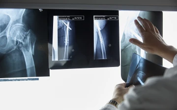 Bild Orthop&auml;die
